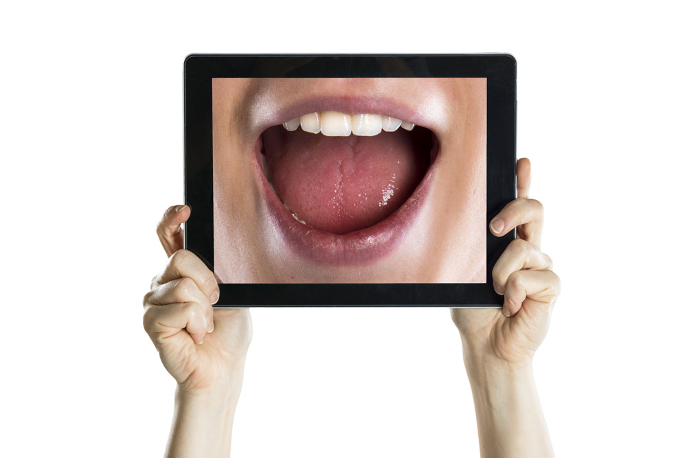 Image representing Root Canal Treatment