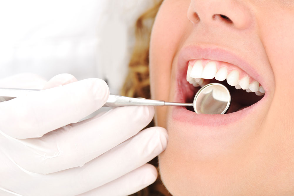 Image representing Fillings
